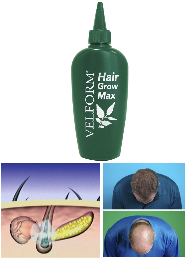 «VELFORM Hair Grow Max» Haarwasser