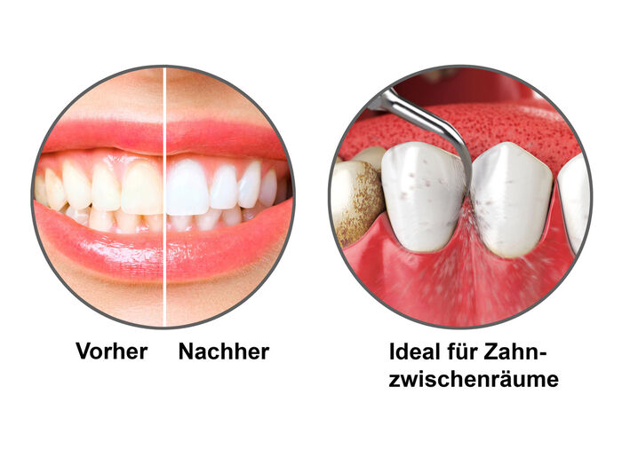 Schallzahnpflege-Set