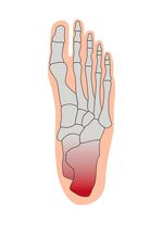 Fersenentlastungspolster 