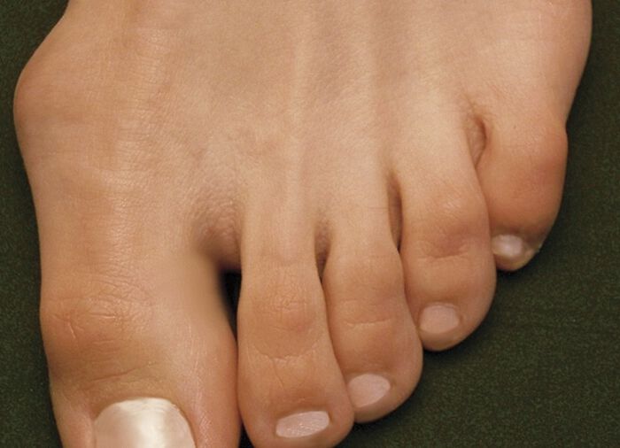 Haflinger Ballerina Valerie WEISS