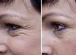 agefit Anti-Falten-Serum in verschiedenen Ausführungen 