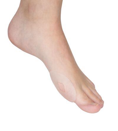  Selbstklebende Gelringe &raquo;gross&raquo;, 4 St&uuml;ck 